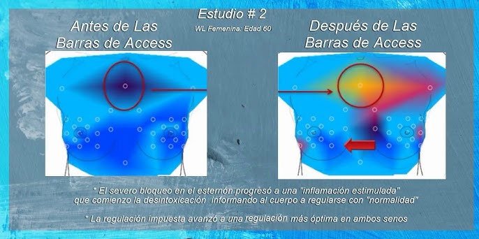 img barras26